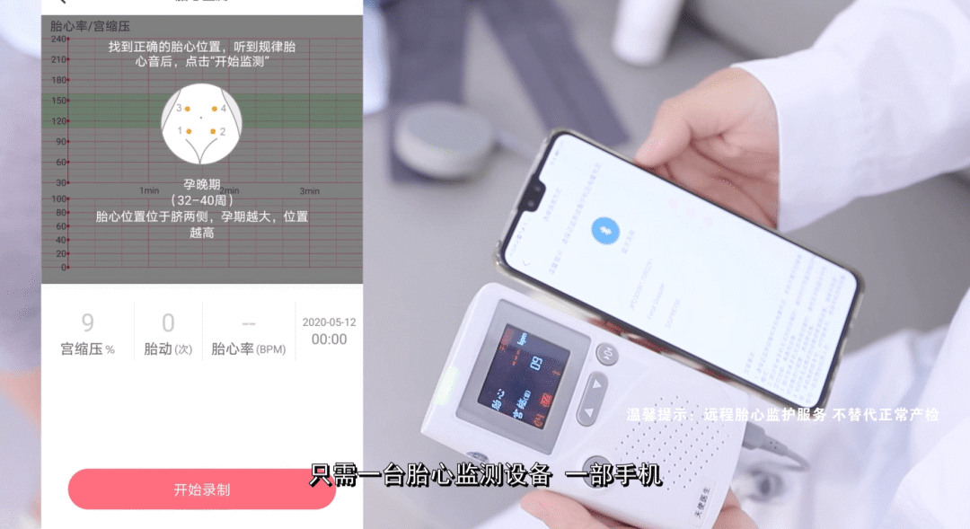 远程胎监_副本.png