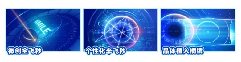 屈光-手术分类.jpg
