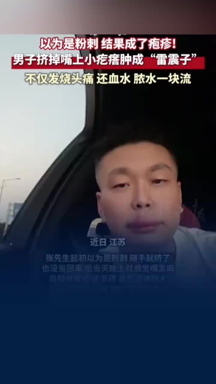 男子挤掉嘴上小疙瘩肿成雷震子，男子误把疱疹当粉刺挤掉后发烧