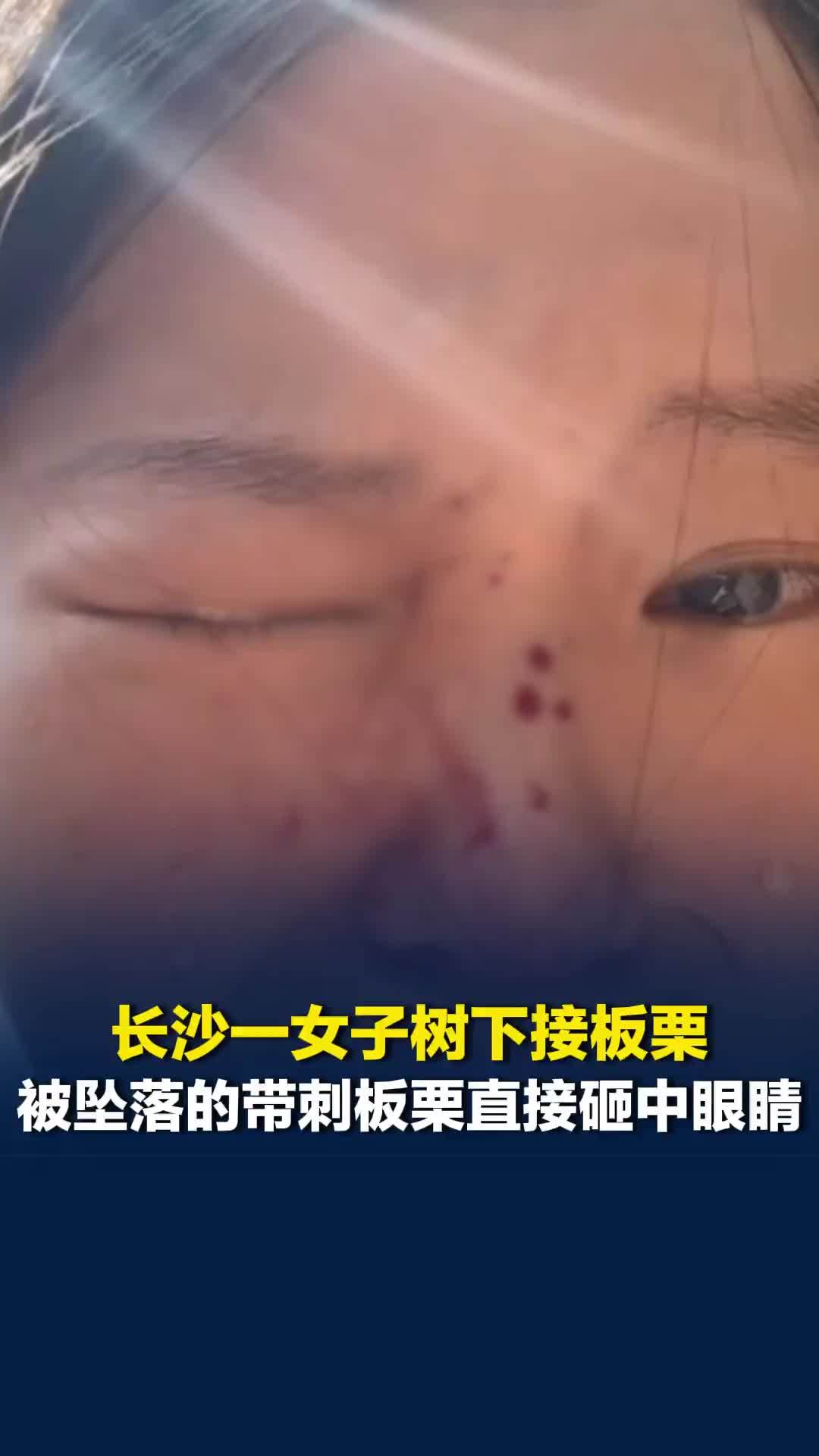 长沙一女子树下接板栗，被带刺板栗直接砸中眼睛，当事人：眼睛里挑出3根刺