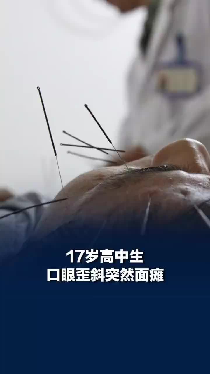 17岁高中生长期熬夜突然面瘫，医生：冷暖交替时节是面瘫高发期