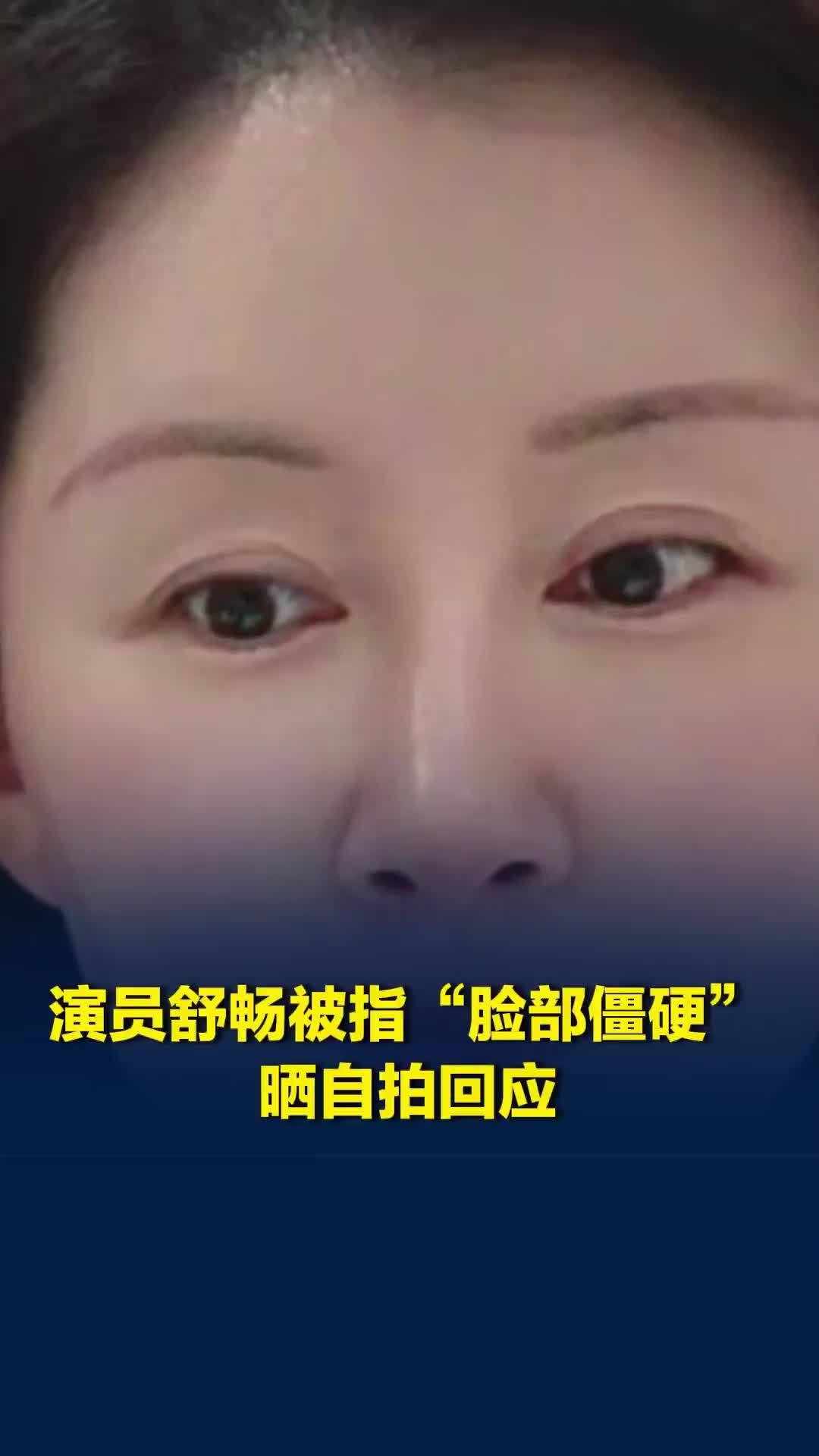 演员舒畅被指“脸部僵硬”，晒自拍回应：我38岁状态挺好的