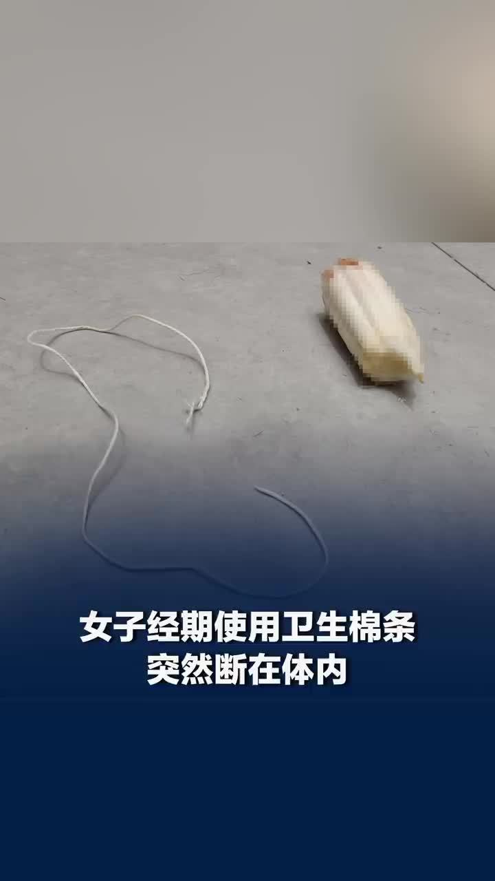 卫生棉条断体内女子冷静取出，女子回应卫生棉条断在体内