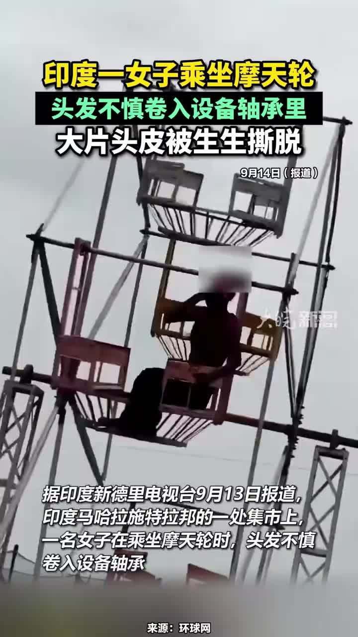 印度一女子乘坐摩天轮，头发不慎卷入设备轴承里，大片头皮被生生撕脱#印度一女子头发卷入摩天轮