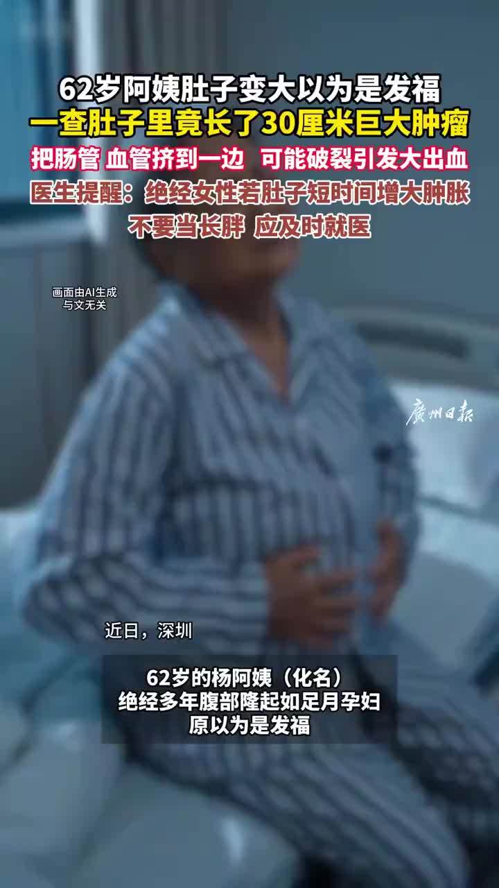 阿姨以为发福查出30厘米肿瘤