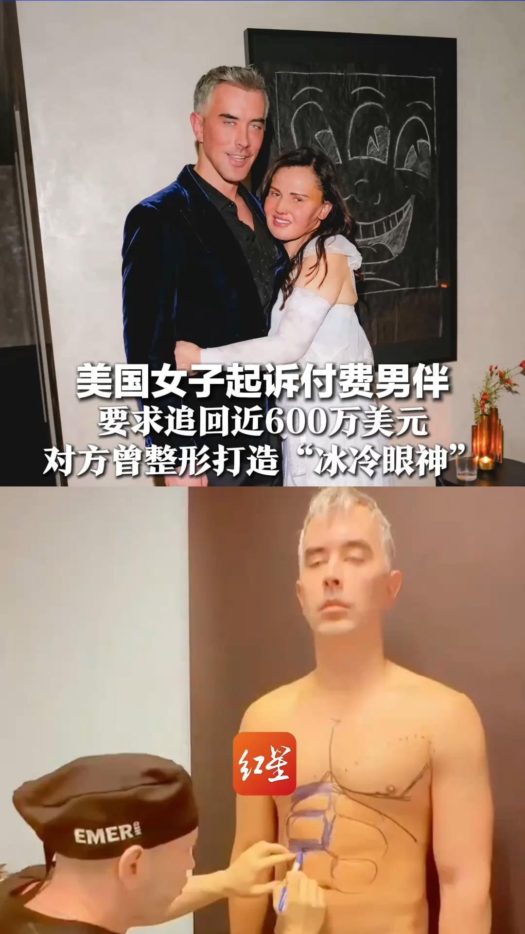 美国女子起诉付费男伴，要求追回近600万美元，对方曾整形打造“冰冷眼神”，自称认真交往，没诈骗