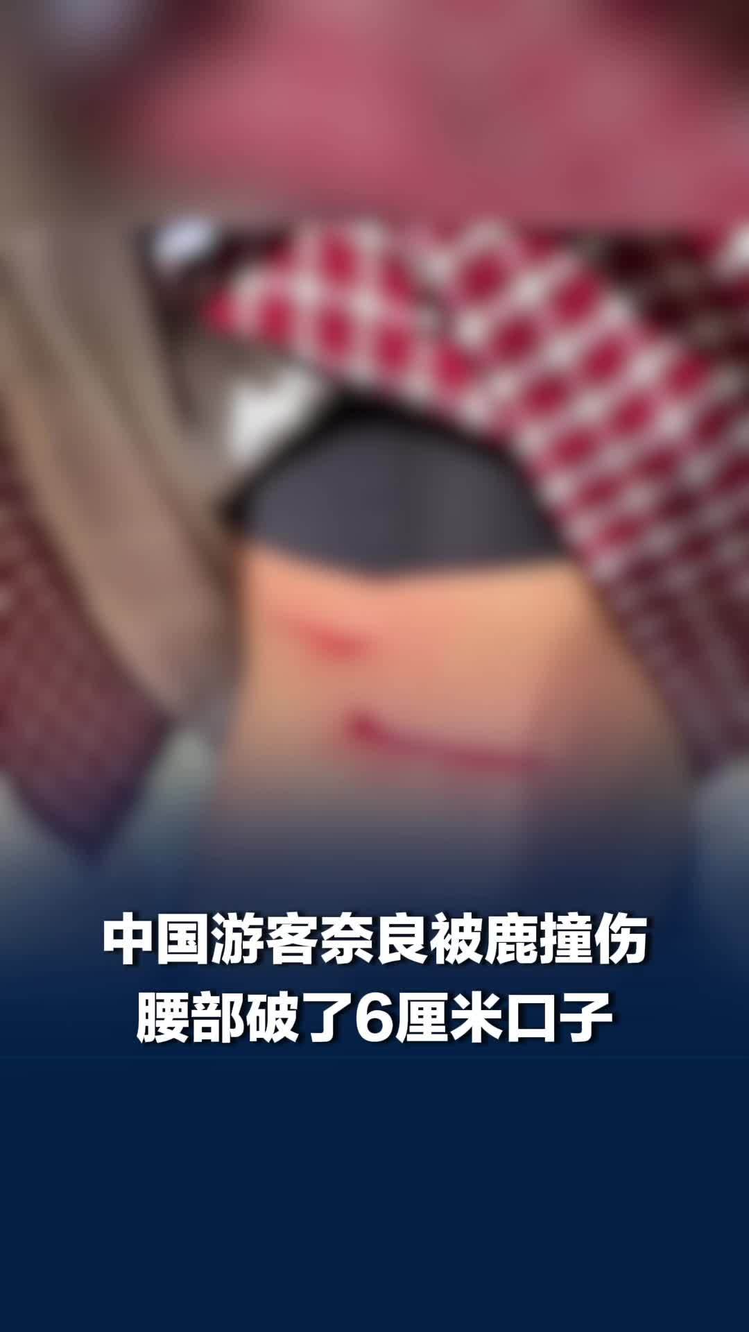 中国游客奈良被鹿袭击撞伤腰部，在日被鹿撞伤中国游客朋友发声：建议近期别去，公鹿发情期太危险