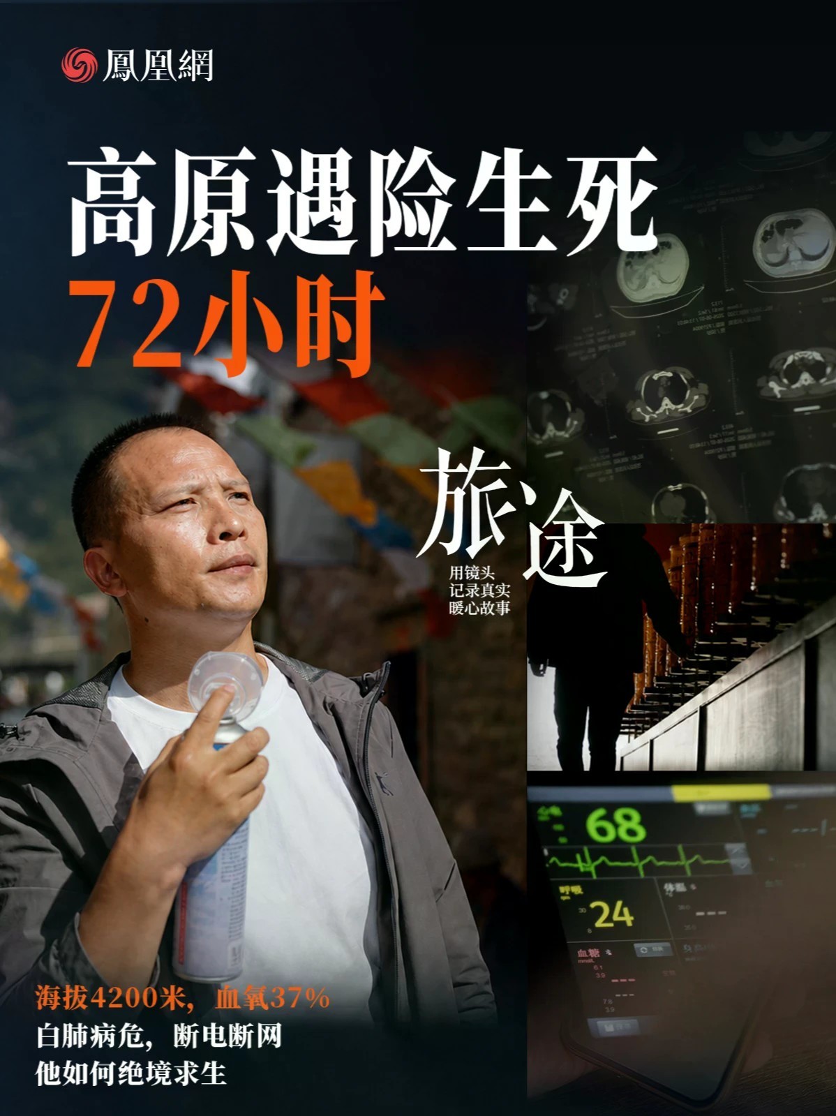 高原遇险生死72小时：白肺病危，断电断网，他如何绝境求生 一次说走就走的川西旅行，差点成了郭磊的生死劫。起初只是头晕、昏沉，血氧跌到60以下，他以为吸点氧就能扛过去，还背着便携制氧仪继续爬海拔420
