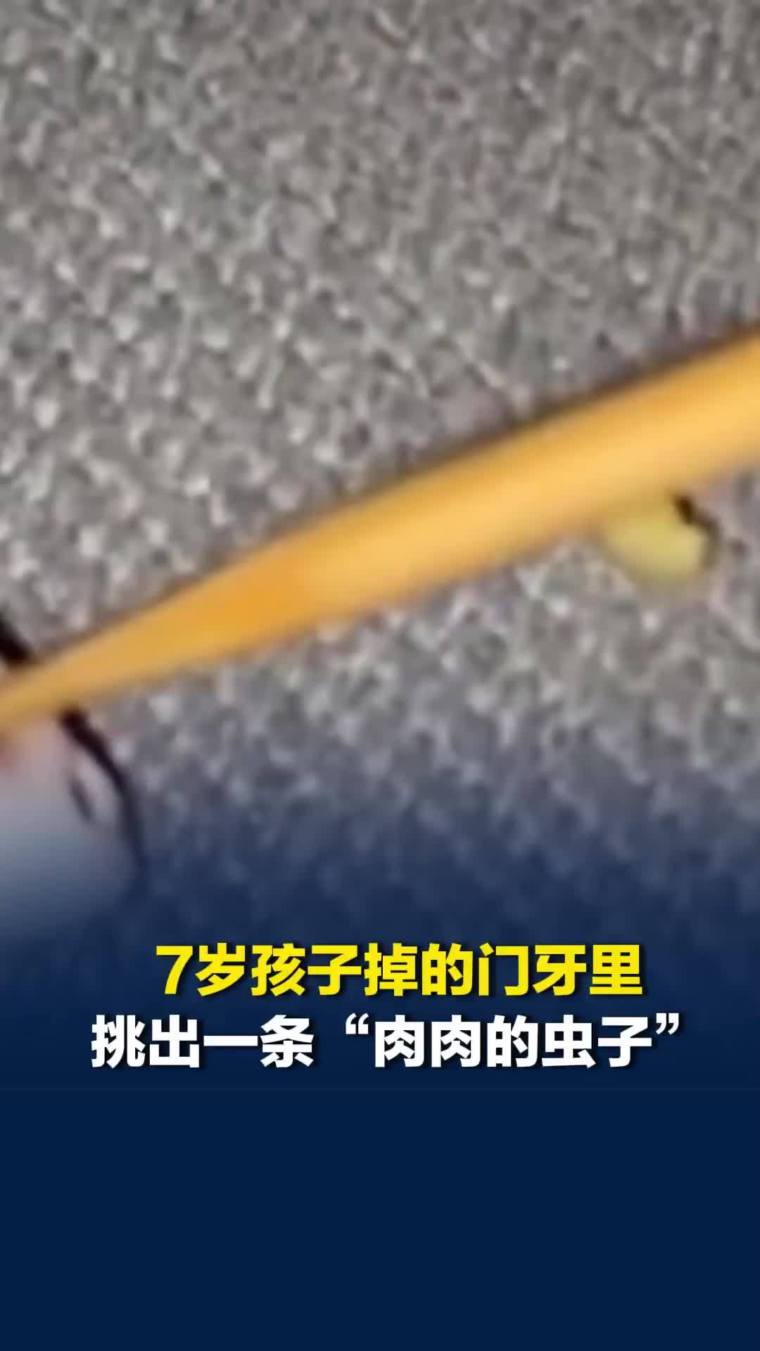 7岁孩子掉的门牙里，挑出一条“肉肉的虫子”，妈妈震惊：牙齿里真的会长虫子？