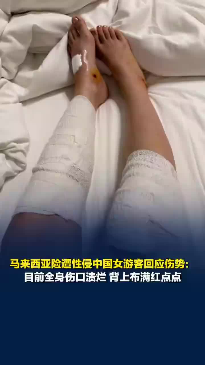 险遭性侵女子称全身伤口溃烂不愈合，仙本那险遭性侵女子安慰家人