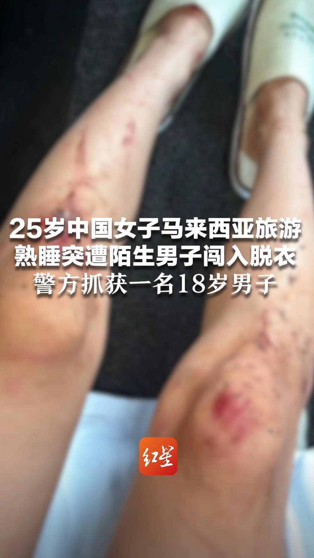 25岁中国女子马来西亚旅游 熟睡突遭陌生男子闯入脱衣 双方扭打后女子逃脱躲进灌木丛 警方抓获一名18岁男子，领馆称正跟进