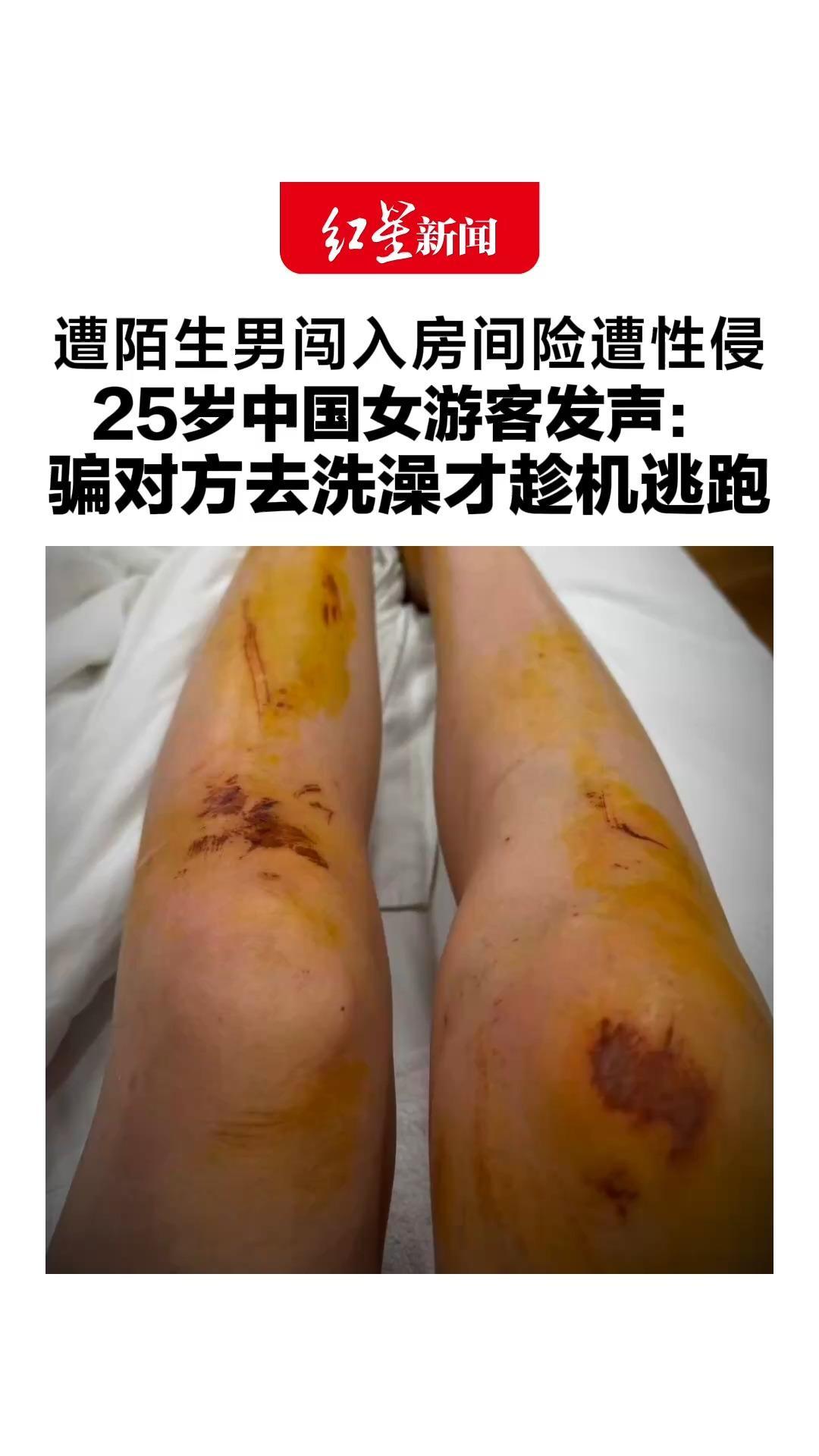 遭陌生男闯入房间险遭性侵，25岁中国女游客发声：骗对方去洗澡才趁机逃跑，已委托律师向马来西亚酒店索赔