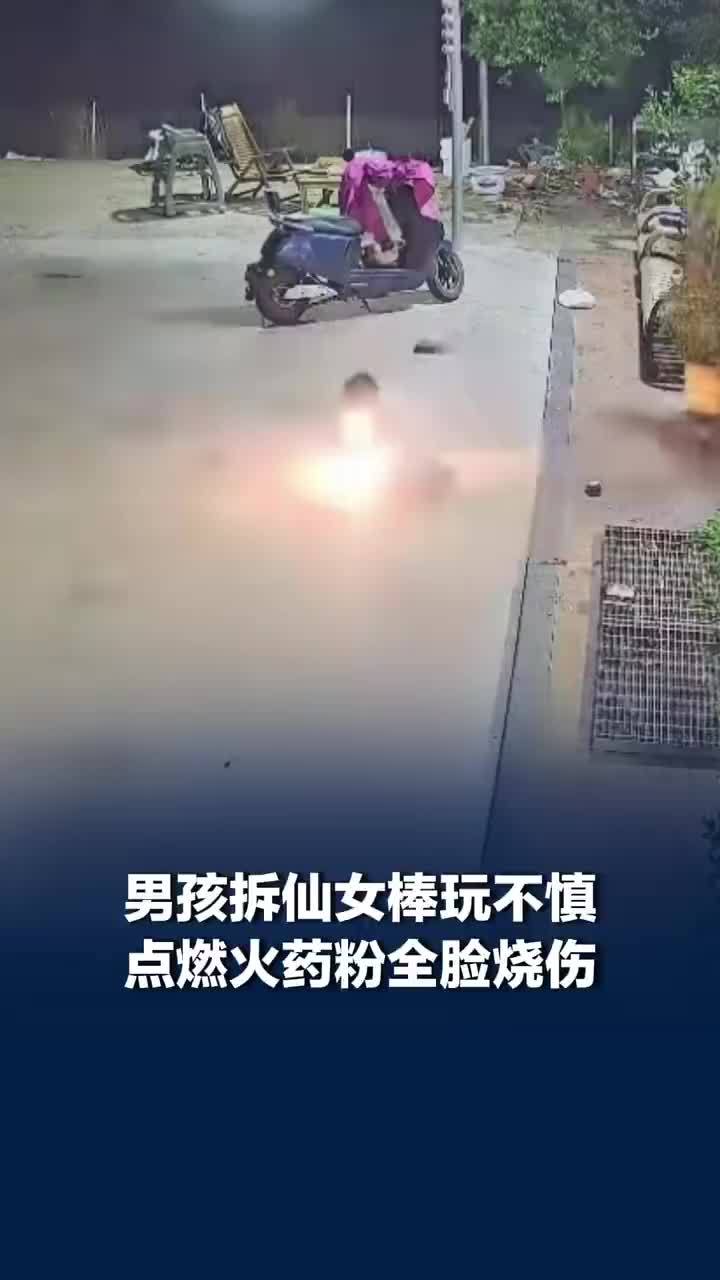 男孩不慎点燃仙女棒火药粉全脸烧伤