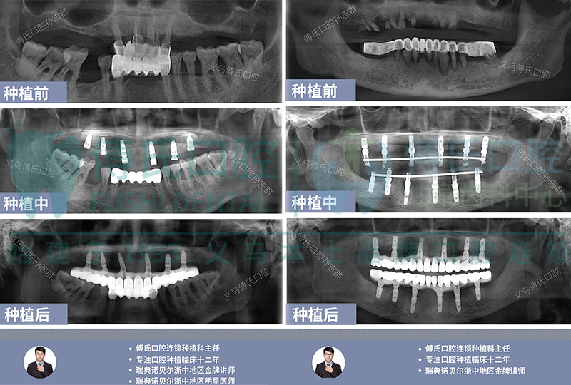 孙志群种植案例