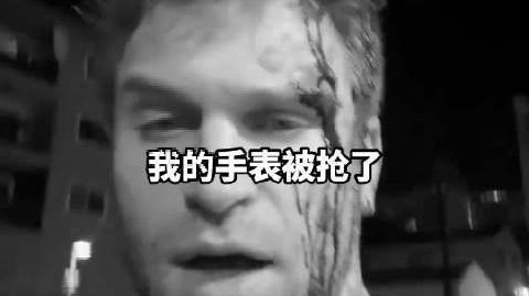 美演员遇袭手表立大功 美男星在西好莱坞被劫满脸是血 “手表救了我一条