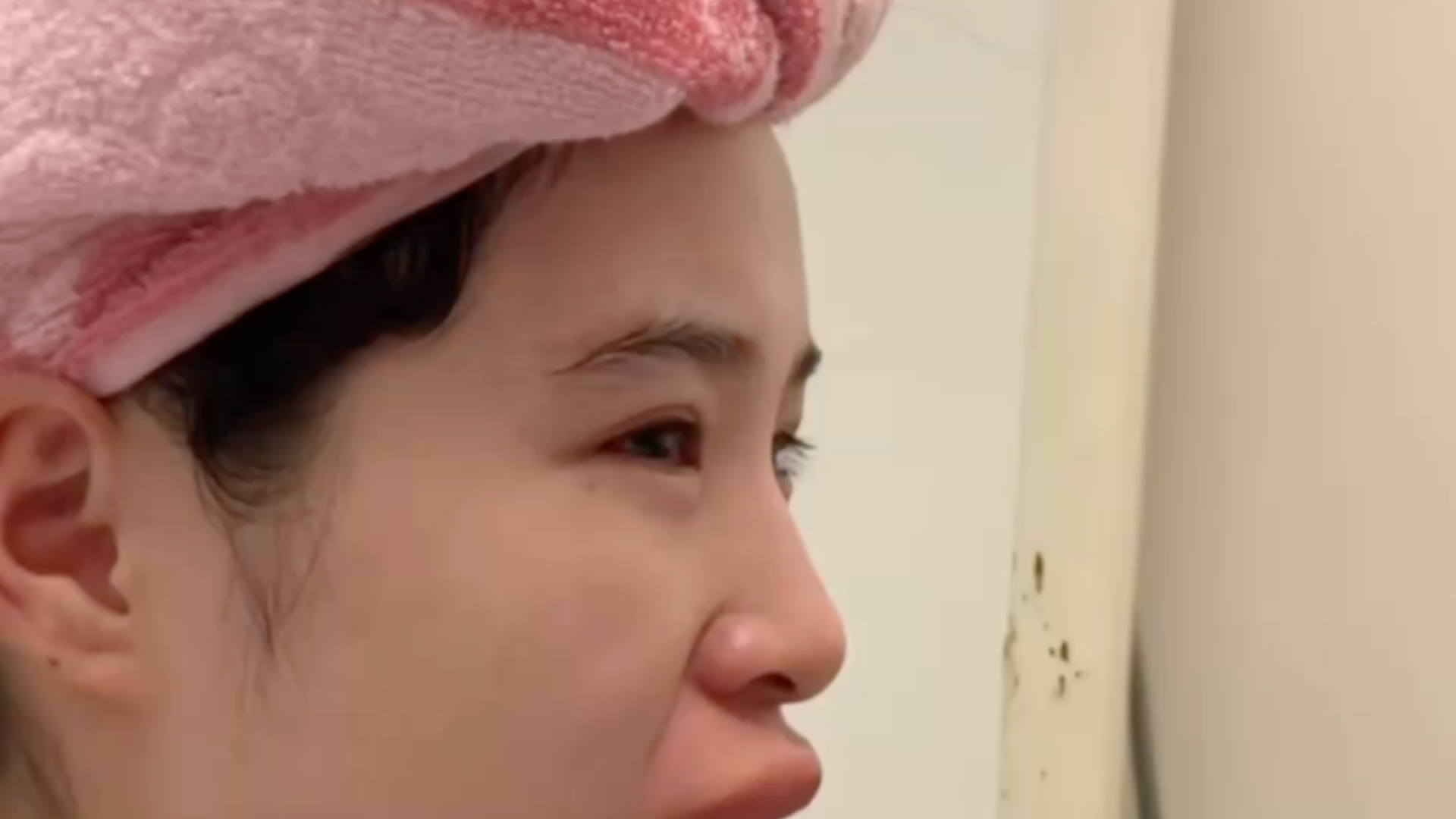 四川一新娘婚礼前两天被马蜂蜇伤，嘴唇肿胀，自嘲“像蛤蟆精”，当事人：连夜就医，婚礼如期举行，但更焦虑了！请看VCR…