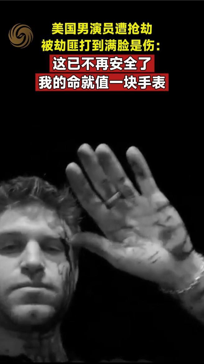 美国男演员遭抢劫被劫匪打到满脸是伤：我的命就值一块手表