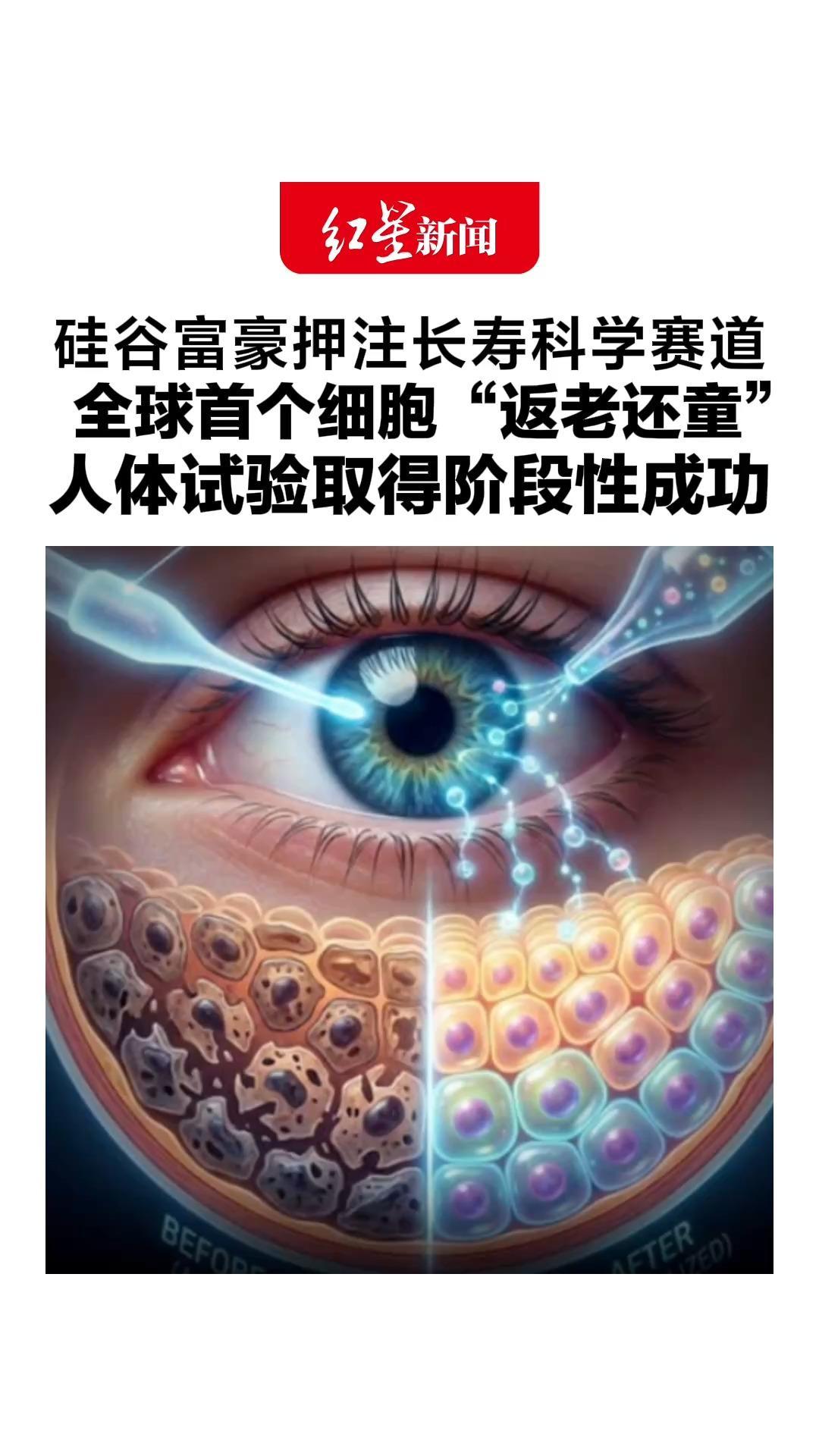 硅谷富豪押注长寿科学赛道，想让细胞“重回”年轻，全球首个细胞“返老还童”，人体试验取得阶段性成功