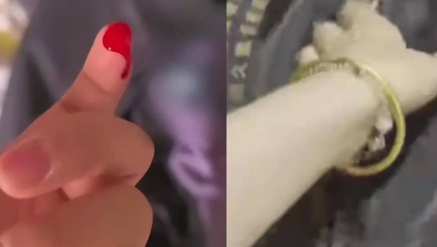 网购衣服藏针扎伤孩子？开口就要3000元，不赔钱就曝光！商家一看视频：不对劲