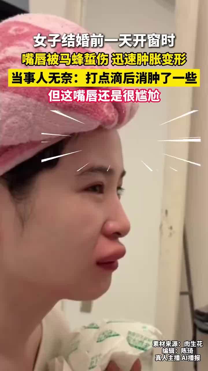 女子结婚前一天嘴唇被马蜂蜇伤，迅速肿胀变形