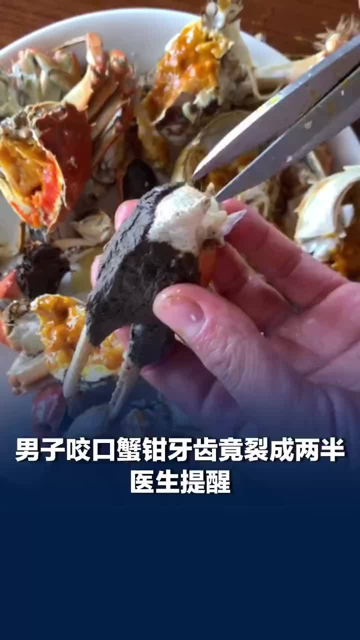 男子根管治疗后咬蟹钳牙齿裂成两半