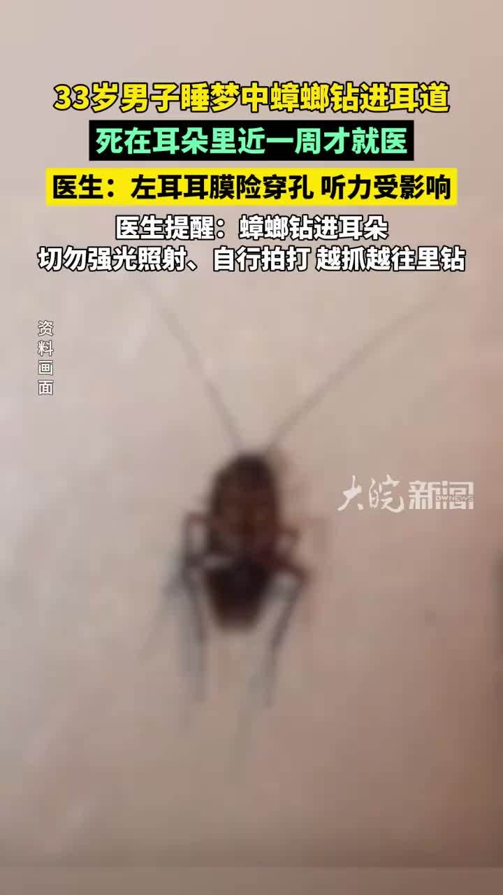 33岁男子睡梦中蟑螂钻进耳道，死在耳朵里近一周就医，医生：左耳耳膜险穿孔，听力受影响 #精选主播说 #媒体原创