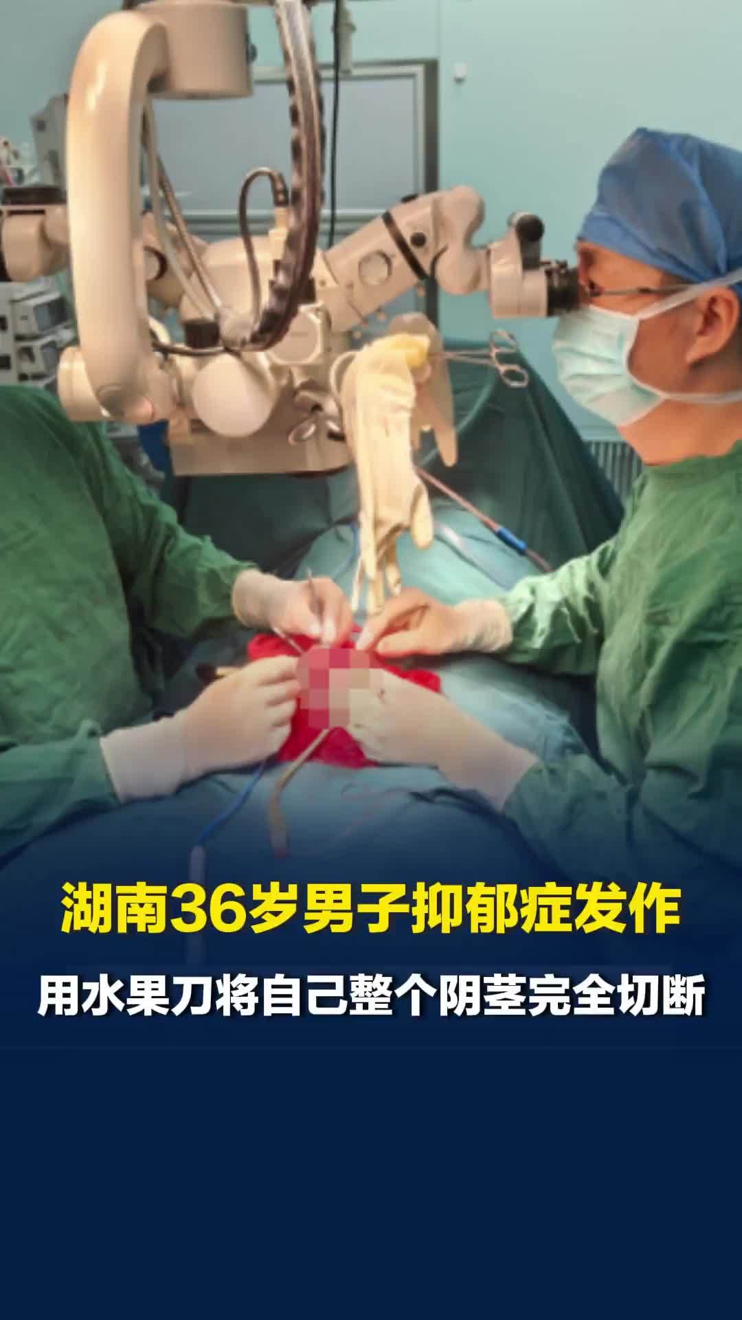 湖南36岁男子抑郁症发作，用水果刀将自己整个阴茎完全切断，经过手术完成再植