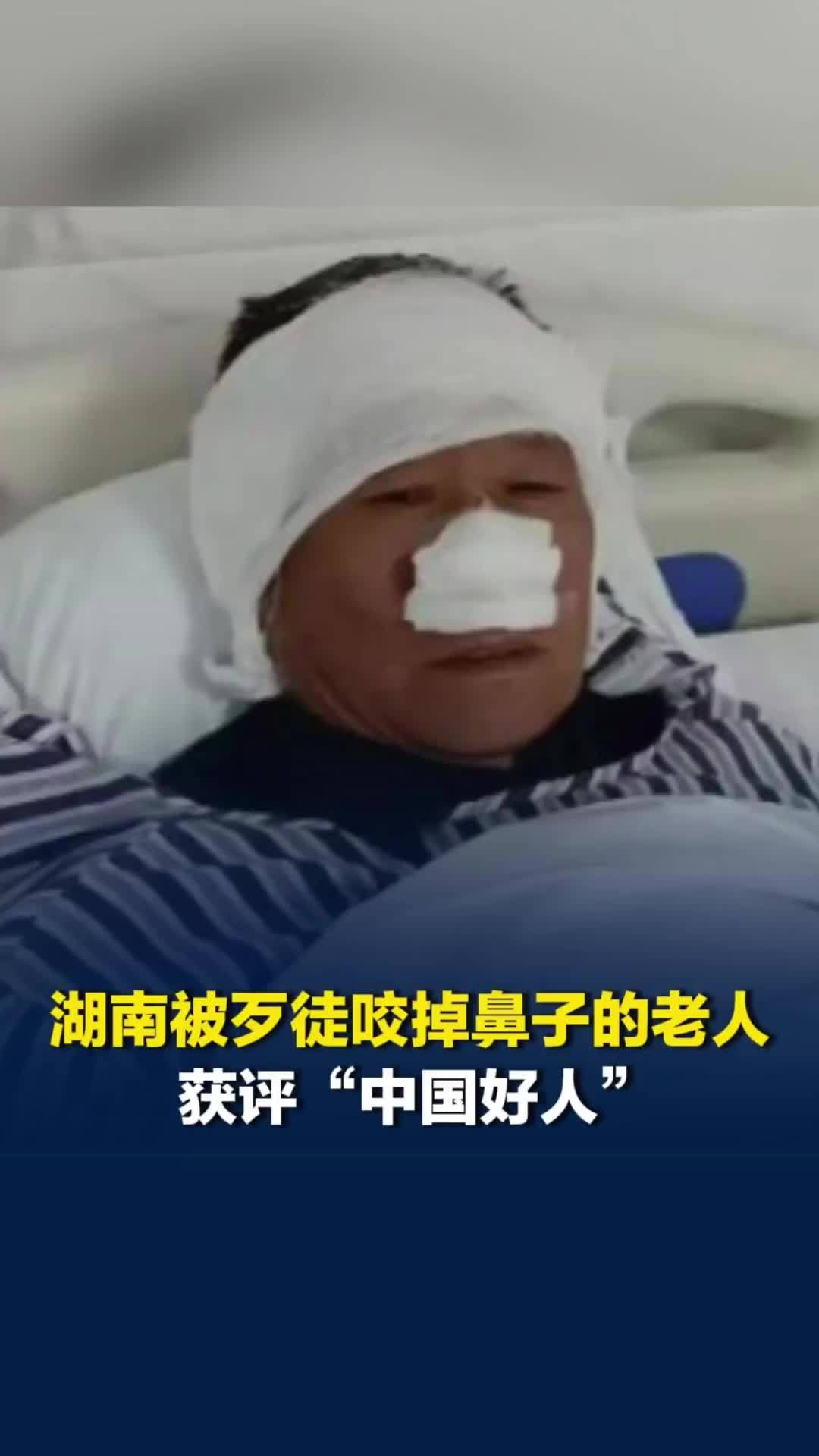 为救人被歹徒咬掉鼻子，湖南70岁老人获评“中国好人”：鼻型基本恢复，但是还没嗅觉