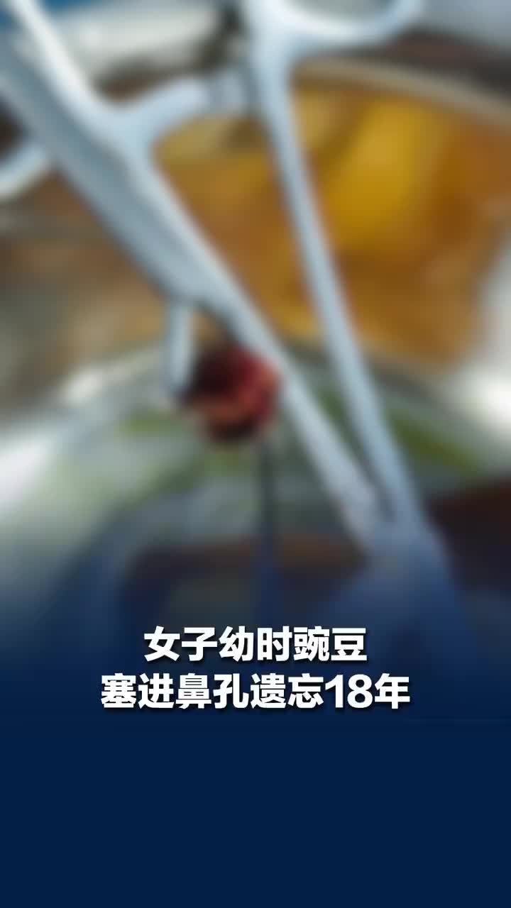 女子幼时豌豆塞鼻孔遗忘18年成鼻石，女子回应豌豆塞鼻孔遗忘18年成鼻石