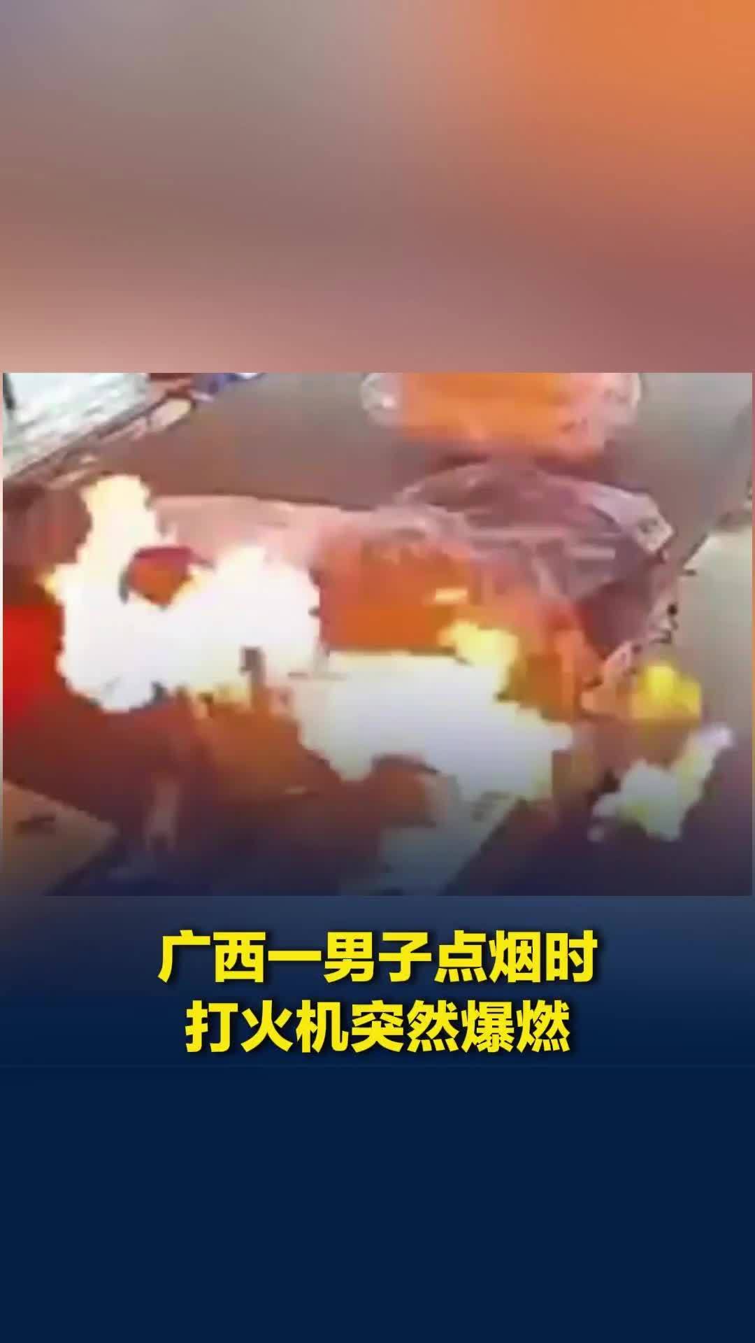 监拍广西一男子点烟时打火机突然爆燃，当事人：1块钱刚买的，头发和眉毛被烧了