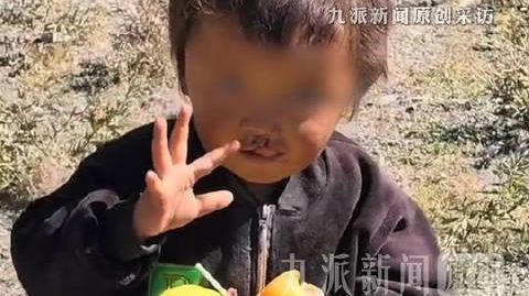 网友偶遇兔唇儿童求助李亚鹏【嫣然医院不到2小时回复求助网友:可为孩子