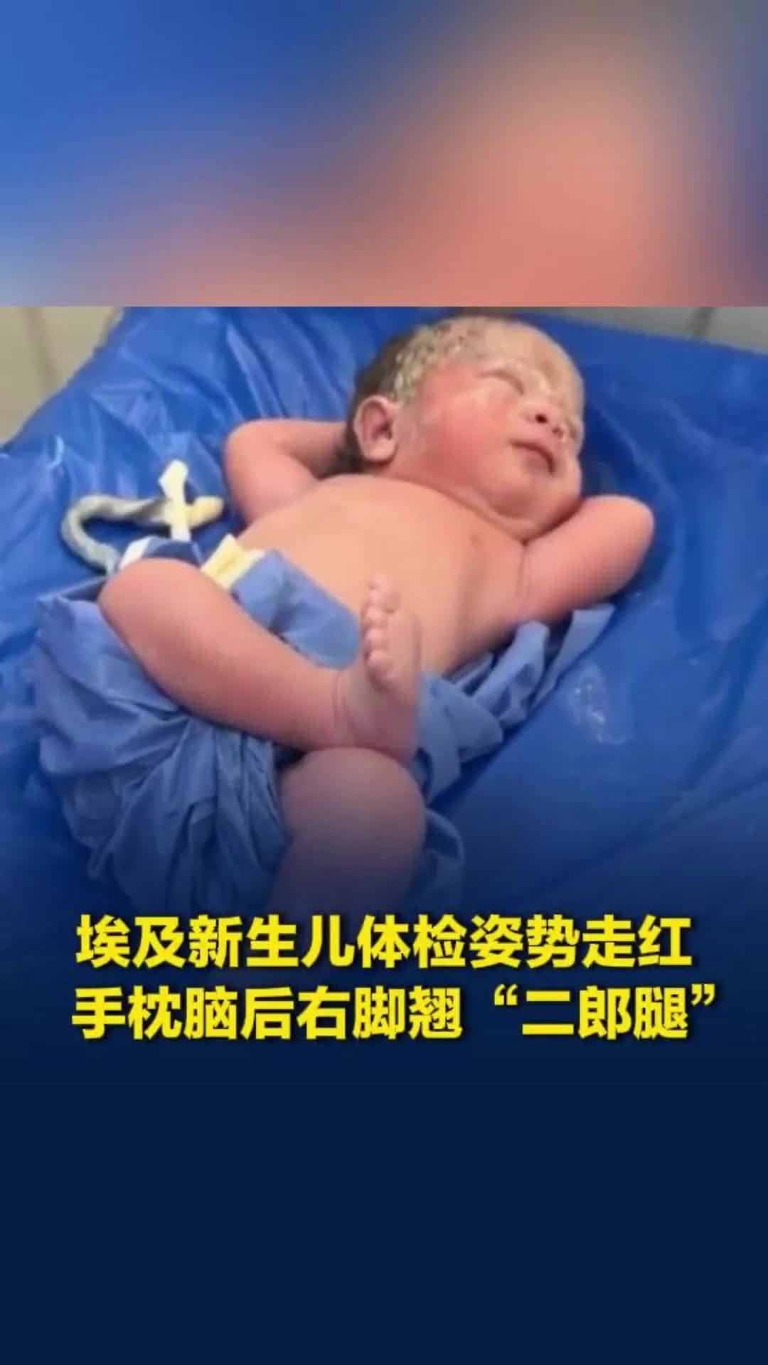 埃及新生儿体检姿势走红，手枕脑后右脚翘“二郎腿”，网友：他可能参透了人生的真谛
