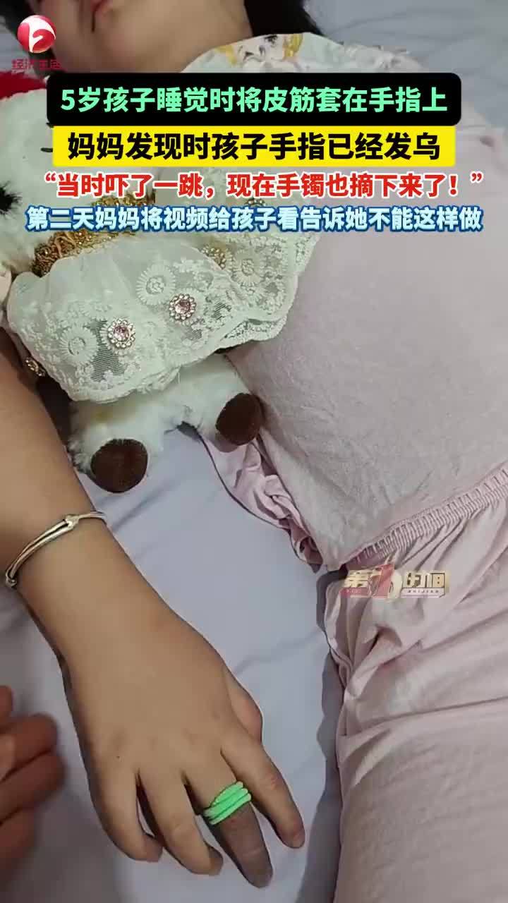 5岁女孩手指套上皮筋睡着手指发乌