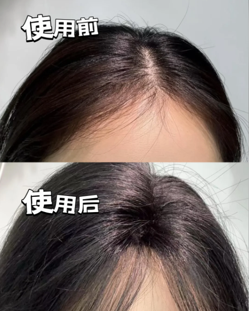双11别错过!初源漾小蛮腰洗发水,蓬松控油一瓶拿捏