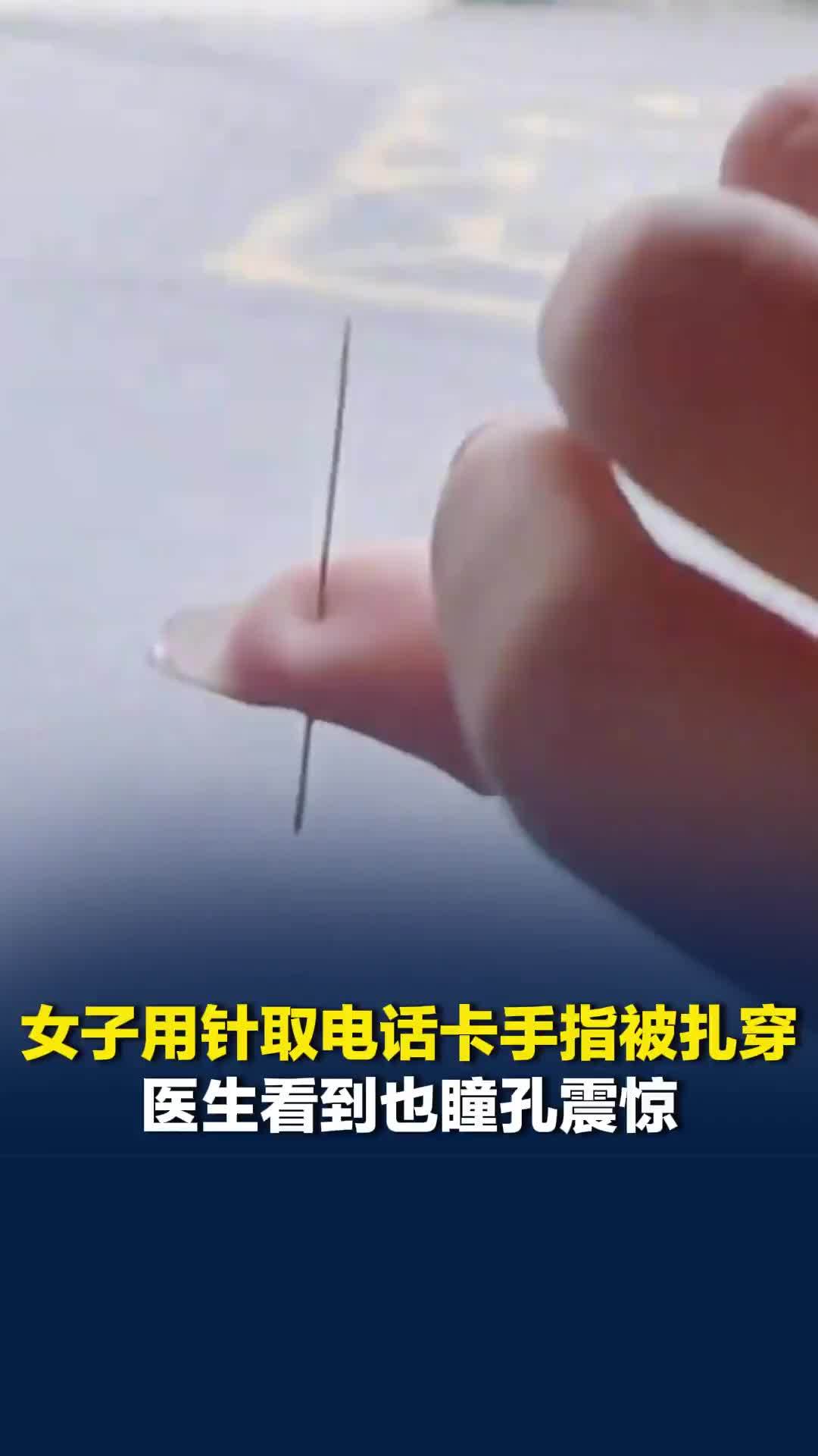 重庆一女子用针取电话卡手指被扎穿：医生看到也瞳孔震惊，消毒后直接拔出，打了破伤风