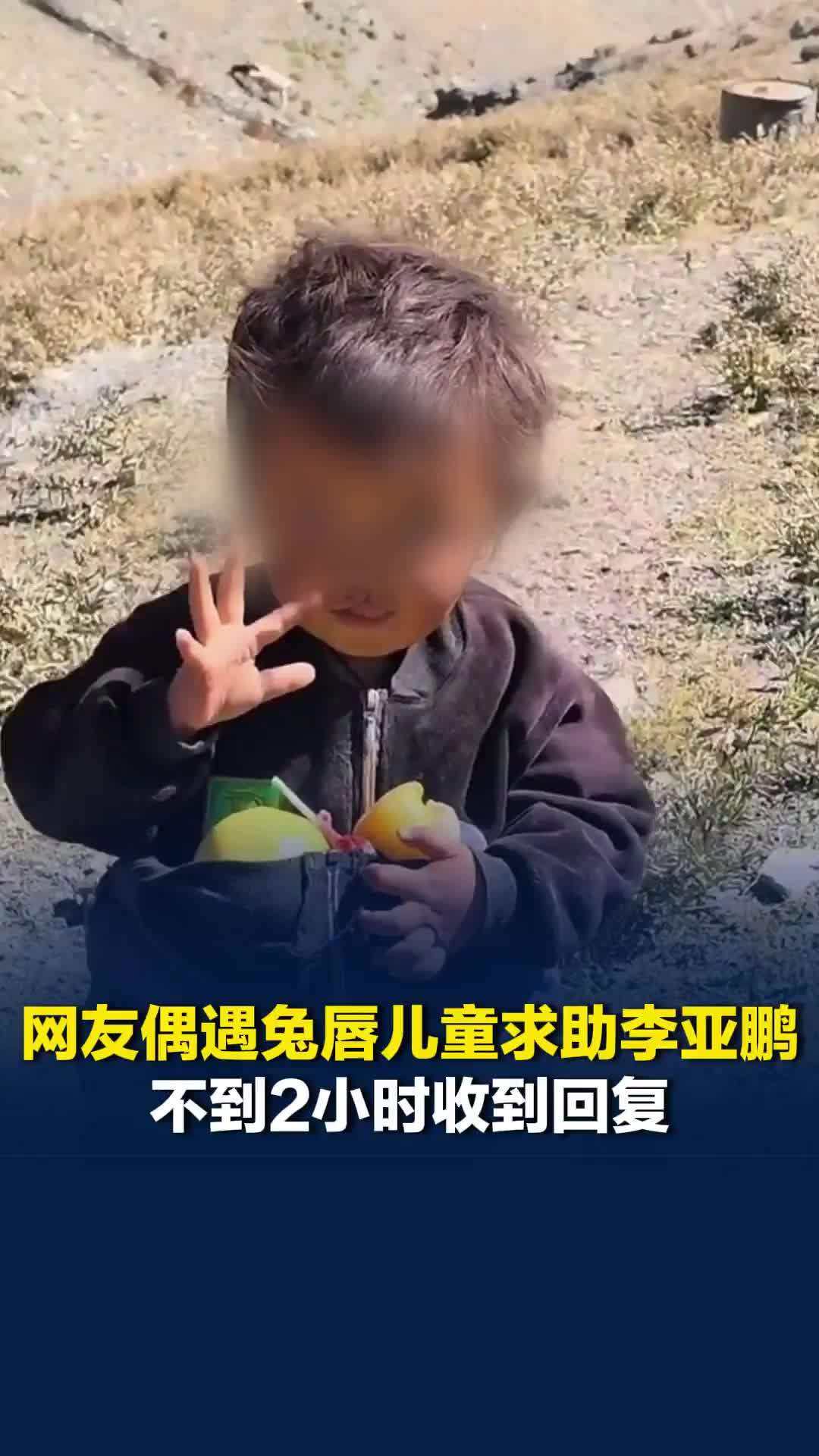 网友偶遇兔唇儿童求助李亚鹏，不到2小时收到回复，嫣然医院：可以提供全额免费治疗