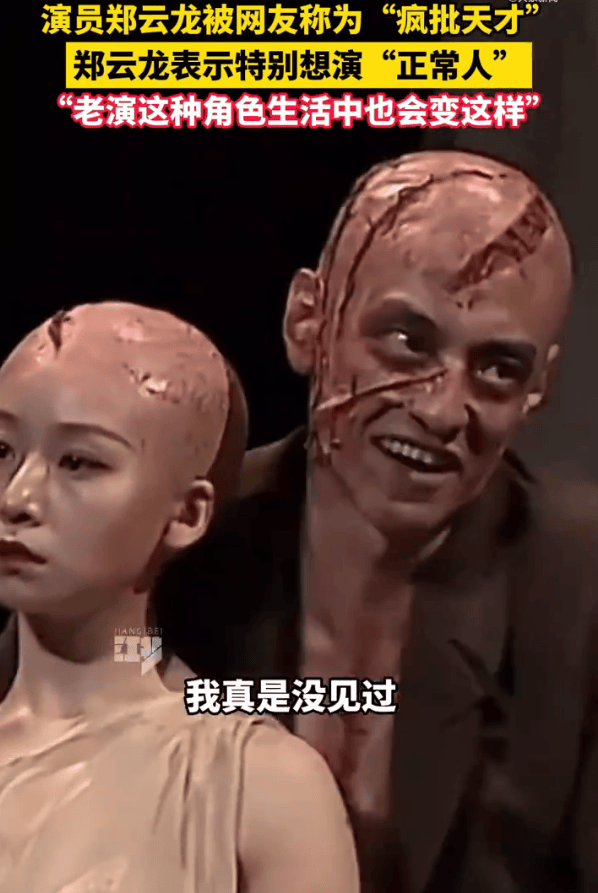 郑云龙称特别想演正常人：全靠想象力在演“疯批”，真的很累