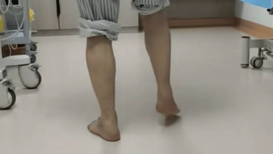 38岁男子走“公鸡步”，脚尖不自觉下垂越来越别扭，“罪魁祸首”找到了！很多人都干