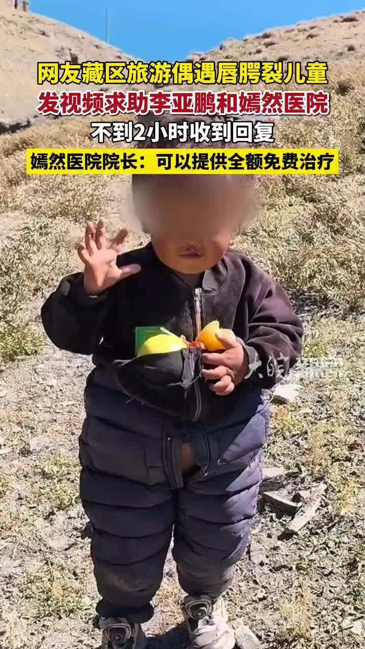 网友藏区旅游偶遇唇腭裂儿童，发视频求助李亚鹏和嫣然医院，不到2小时收到回复，院方称愿接孩子到北京免费治疗 #嫣然医院 #嫣然医院回应网友偶遇唇腭裂儿童 #精选主播说