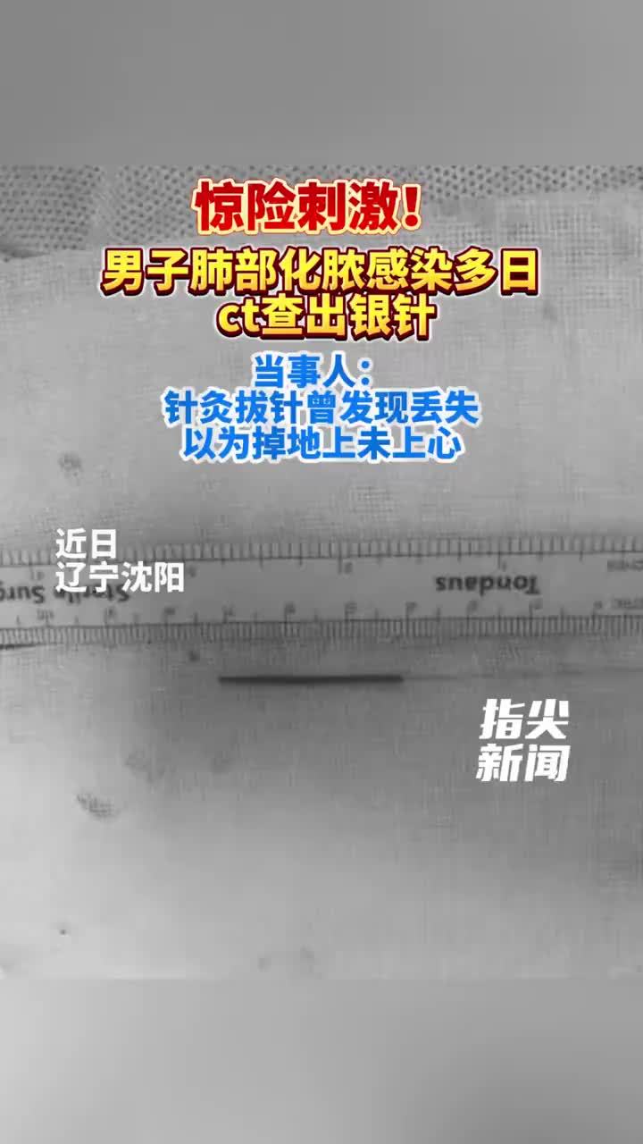 男子患严重肺炎竟因一根银针