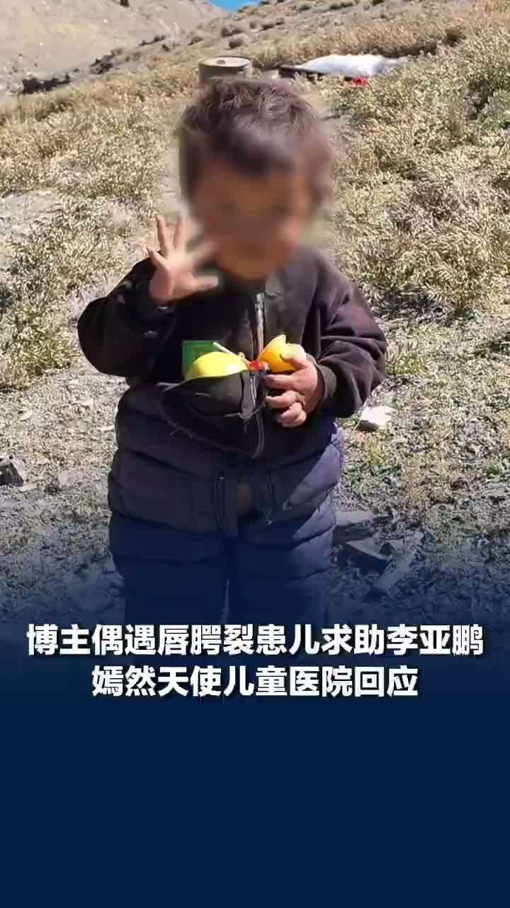 博主偶遇唇腭裂患儿求助李亚鹏，博主求助后嫣然医院将安排患儿治疗