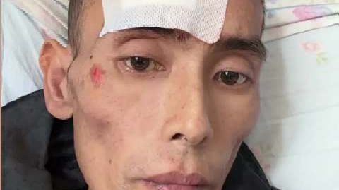 肝癌去世网红曾劝诫大家少喝酒少熬夜 39岁网红确诊肝癌仅9个月离世