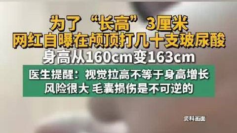 【#医生回应网红为长高颅顶打玻尿酸#】网红为视觉 “长高” 3 厘米