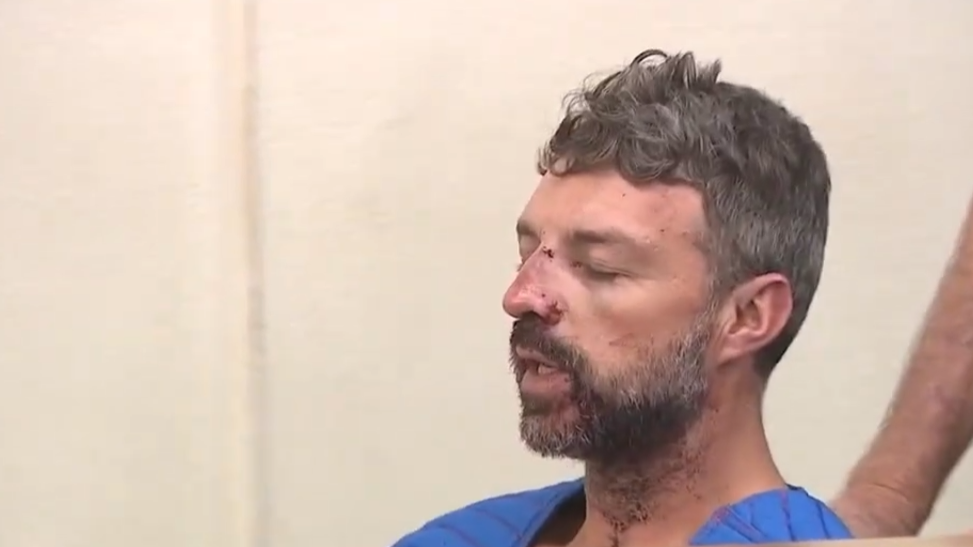 人咬警犬算不算袭警？美国男子拒捕后张嘴反咬警犬，警察气愤大喊“别咬我的狗”