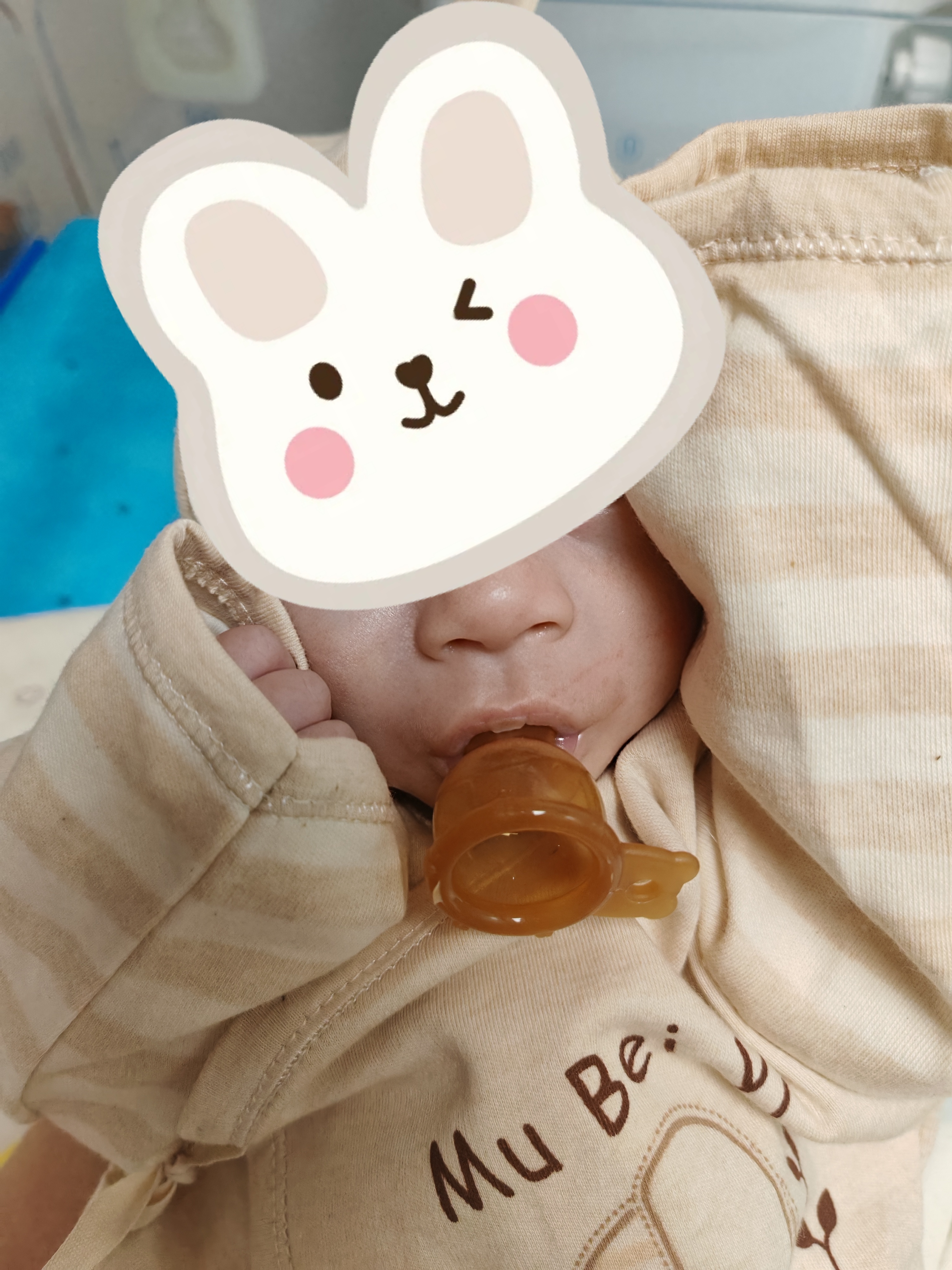 800克到2050克:一个“巴掌宝宝”的百日突围——克州人民医院成功救治一例超低出生体重超早产儿
